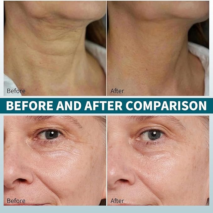 Skin Repair Cream