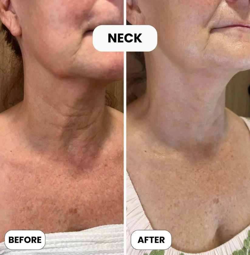 Skin Repair Cream