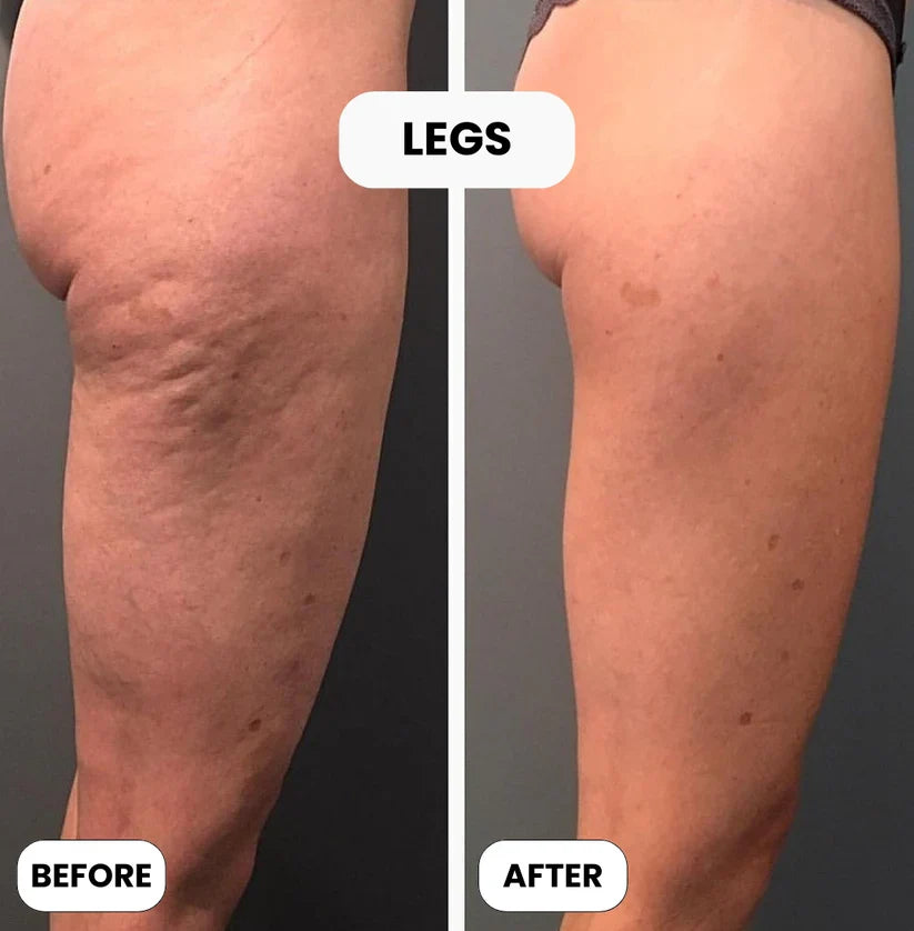 Skin Repair Cream