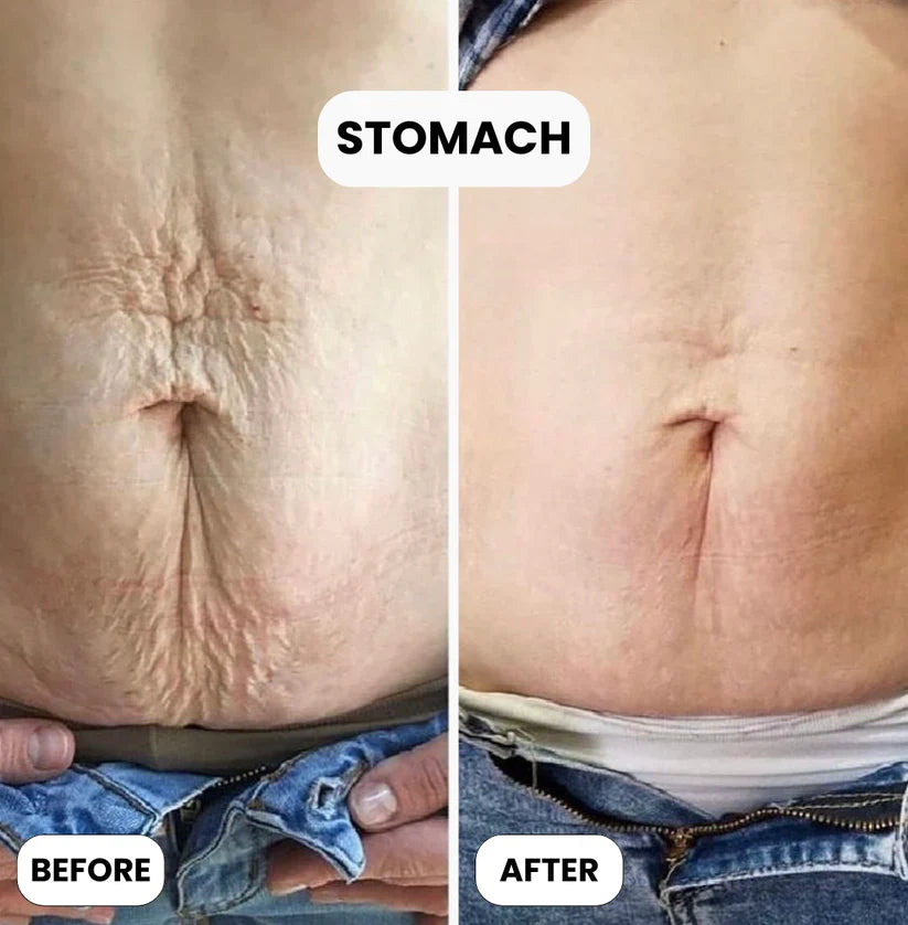 Skin Repair Cream