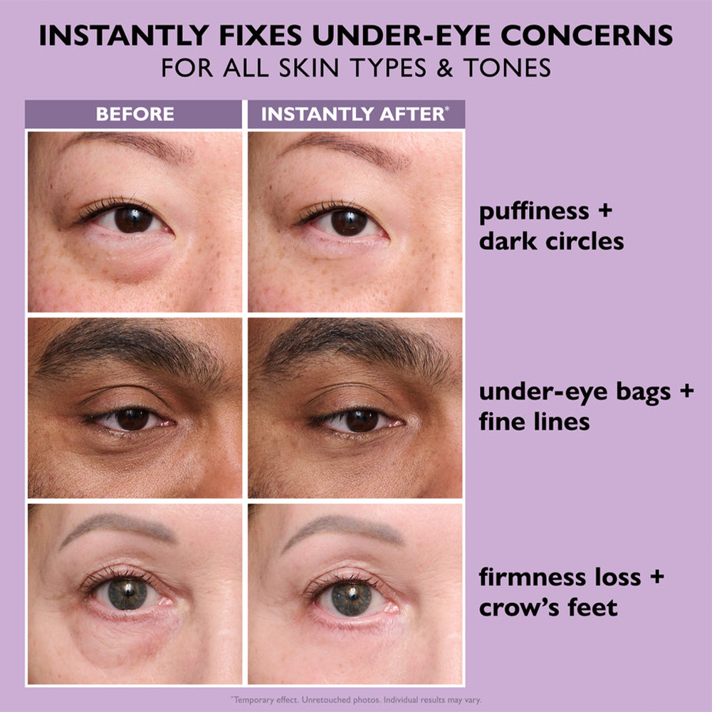 🌸Instant Eye Tightener Easy-Wear Formula-Ultimate Lift &Smooth Finish ✨