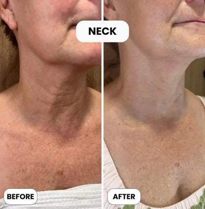 Skin Repair Cream